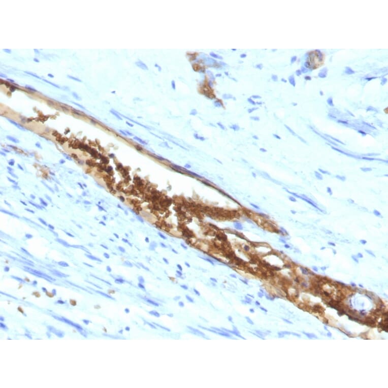 Immunohistochemistry - Anti-Blood Group Antigen A Antibody [3-3A] - BSA and Azide free (A251936) - Antibodies.com