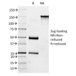 SDS-PAGE - Anti-Blood Group Antigen A Antibody [3-3A] - BSA and Azide free (A251937) - Antibodies.com
