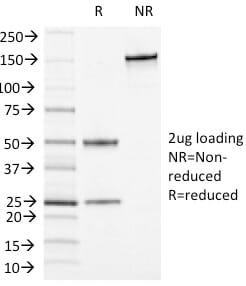 SDS-PAGE analysis of Anti-CD13 Antibody [APN/1464] under non-reduced and reduced conditions; showing intact IgG and intact heavy and light chains, respectively. SDS-PAGE analysis confirms the integrity and purity of the antibody.