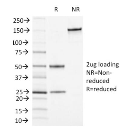 SDS-PAGE - Anti-CD13 Antibody [APN/1464] - BSA and Azide free (A251939) - Antibodies.com
