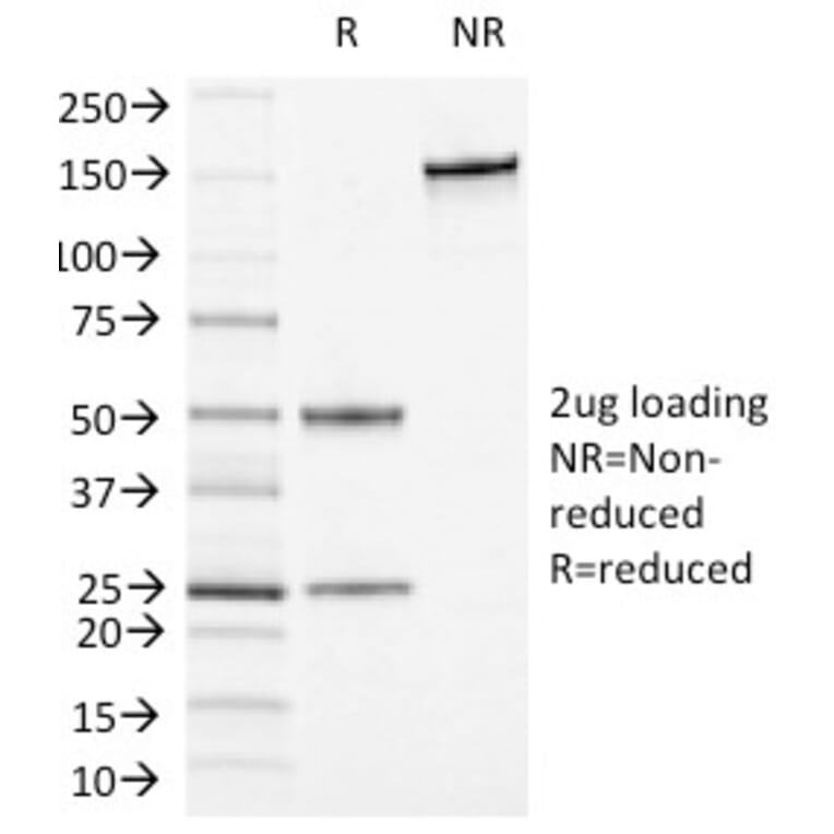 SDS-PAGE - Anti-CD13 Antibody [APN/1464] - BSA and Azide free (A251939) - Antibodies.com