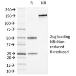 SDS-PAGE - Anti-CD13 Antibody [APN/1464] - BSA and Azide free (A251939) - Antibodies.com