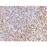 Immunohistochemistry - Anti-Galectin 13 Antibody [PP13/1161] - BSA and Azide free (A251942) - Antibodies.com