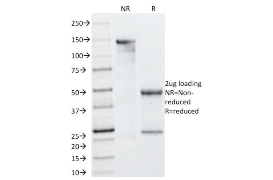 SDS-PAGE - Anti-Galectin 13 Antibody [PP13/1161] - BSA and Azide free (A251942) - Antibodies.com