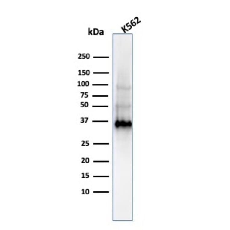 Western Blot - Anti-Galectin 13 Antibody [PP13/1161] - BSA and Azide free (A251942) - Antibodies.com