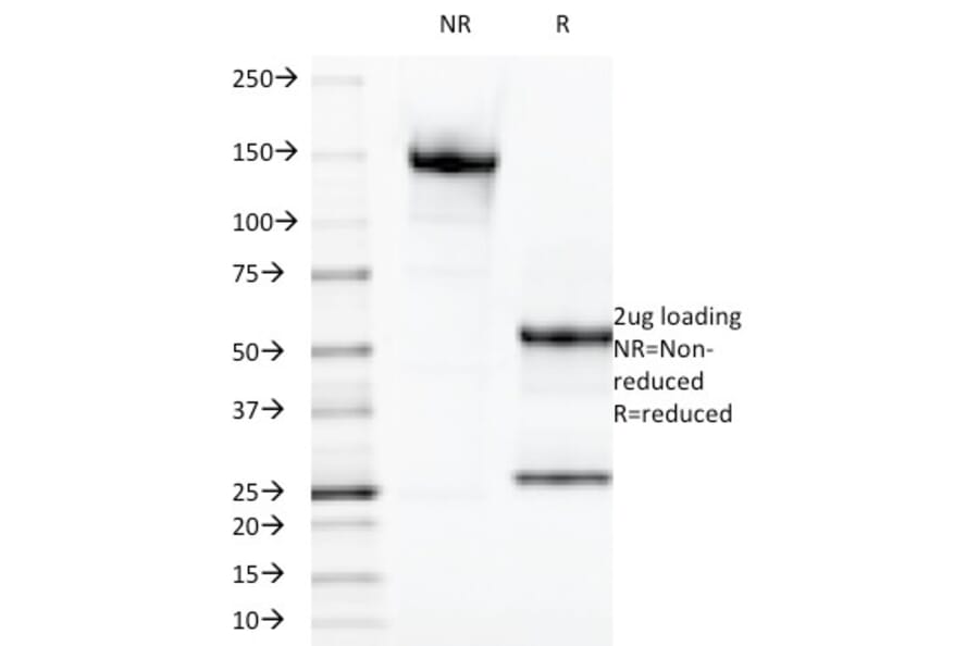 SDS-PAGE - Anti-Galectin 13 Antibody [PP13/1165] - BSA and Azide free (A251945) - Antibodies.com