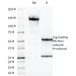 SDS-PAGE - Anti-Galectin 13 Antibody [PP13/1165] - BSA and Azide free (A251945) - Antibodies.com