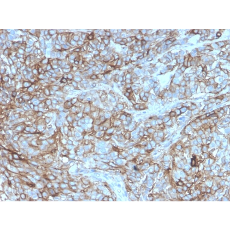 Immunohistochemistry - Anti-PD-L1 Antibody [rPDL1/4772] - BSA and Azide free (A251946) - Antibodies.com