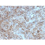 Immunohistochemistry - Anti-PD-L1 Antibody [rPDL1/4772] - BSA and Azide free (A251946) - Antibodies.com