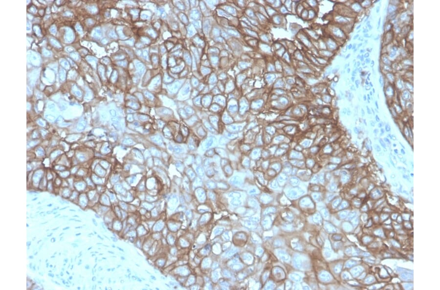 Immunohistochemistry - Anti-PD-L1 Antibody [rPDL1/4772] - BSA and Azide free (A251945) - Antibodies.com
