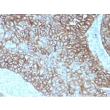 Immunohistochemistry - Anti-PD-L1 Antibody [rPDL1/4772] - BSA and Azide free (A251945) - Antibodies.com