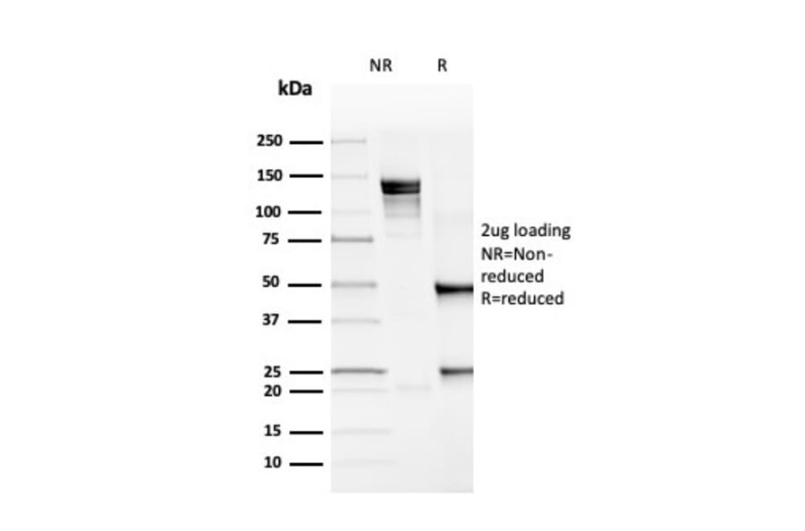 SDS-PAGE - Anti-PD-L1 Antibody [rPDL1/4772] - BSA and Azide free (A251946) - Antibodies.com