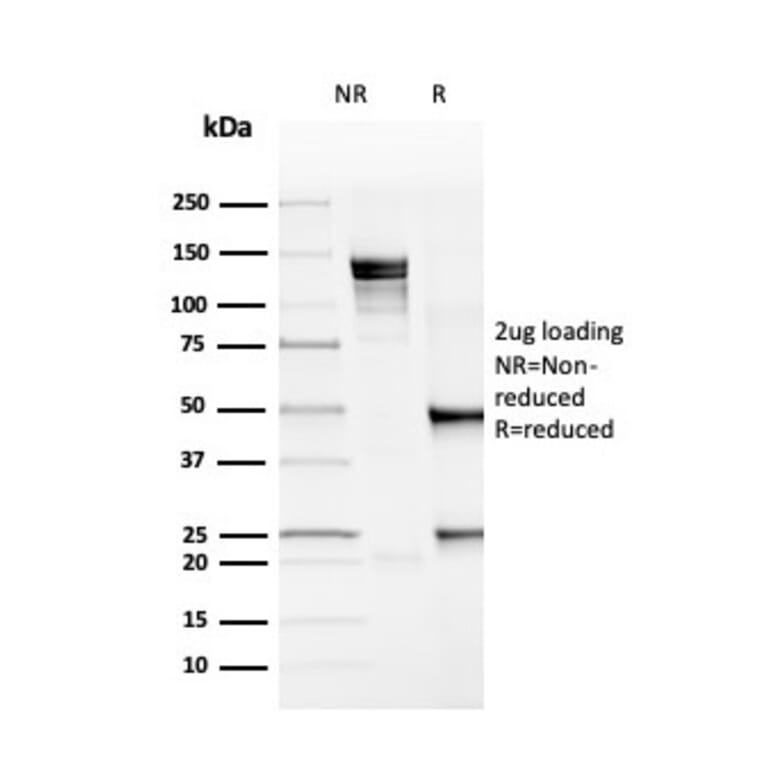 SDS-PAGE - Anti-PD-L1 Antibody [rPDL1/4772] - BSA and Azide free (A251946) - Antibodies.com