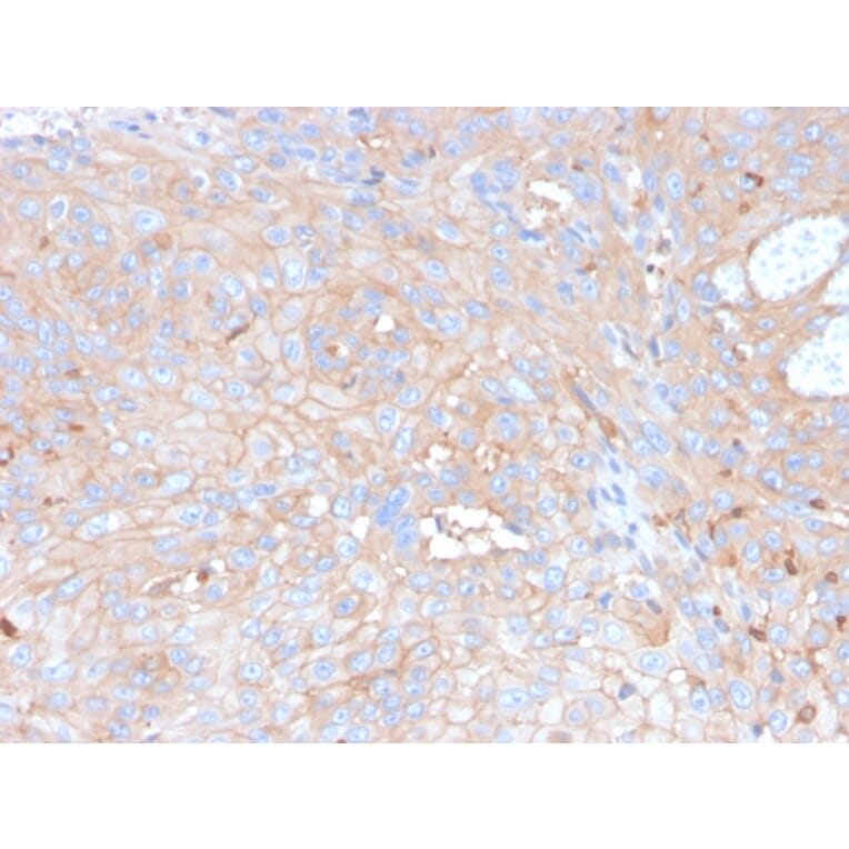 Immunohistochemistry - Anti-PD-L1 Antibody [rPDL1/4773] - BSA and Azide free (A251947) - Antibodies.com