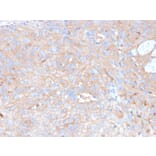Immunohistochemistry - Anti-PD-L1 Antibody [rPDL1/4773] - BSA and Azide free (A251947) - Antibodies.com