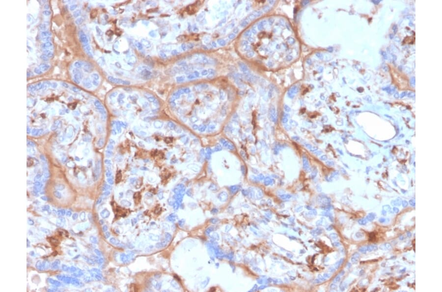 Immunohistochemistry - Anti-PD-L1 Antibody [rPDL1/4773] - BSA and Azide free (A251946) - Antibodies.com
