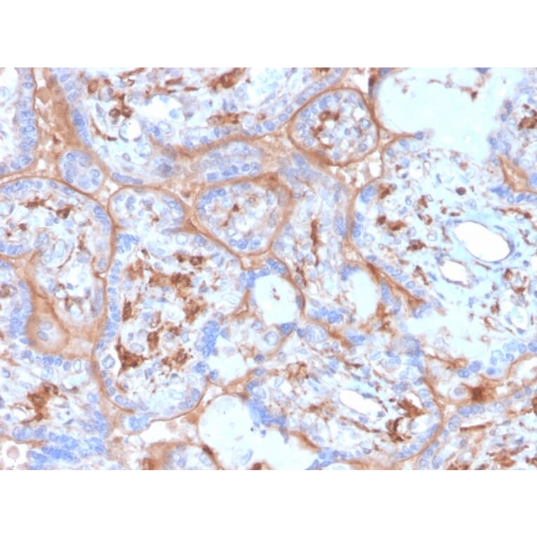 Immunohistochemistry - Anti-PD-L1 Antibody [rPDL1/4773] - BSA and Azide free (A251946) - Antibodies.com