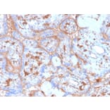 Immunohistochemistry - Anti-PD-L1 Antibody [rPDL1/4773] - BSA and Azide free (A251946) - Antibodies.com