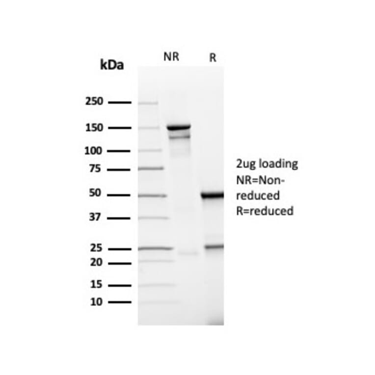 SDS-PAGE - Anti-PD-L1 Antibody [rPDL1/4773] - BSA and Azide free (A251947) - Antibodies.com