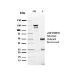 SDS-PAGE - Anti-PD-L1 Antibody [rPDL1/4773] - BSA and Azide free (A251947) - Antibodies.com