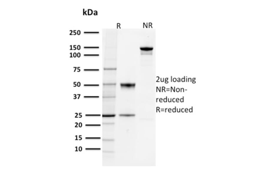 SDS-PAGE - Anti-PD-L1 Antibody [PDL1/2744] - BSA and Azide free (A251951) - Antibodies.com