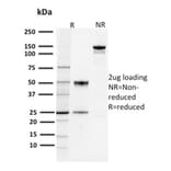 SDS-PAGE - Anti-PD-L1 Antibody [PDL1/2744] - BSA and Azide free (A251951) - Antibodies.com