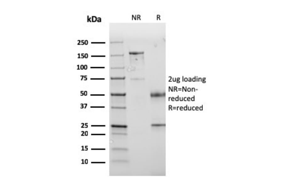 SDS-PAGE - Anti-PD-L1 Antibody [PDL1/2745] - BSA and Azide free (A251952) - Antibodies.com