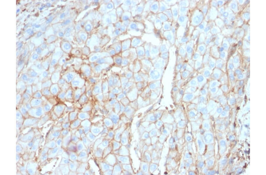 Immunohistochemistry - Anti-PD-L1 Antibody [PDL1/2746] - BSA and Azide free (A251953) - Antibodies.com