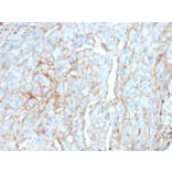 Immunohistochemistry - Anti-PD-L1 Antibody [PDL1/2746] - BSA and Azide free (A251953) - Antibodies.com