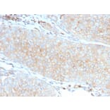 Immunohistochemistry - Anti-PD-L1 Antibody [PDL1/2746] - BSA and Azide free (A251952) - Antibodies.com