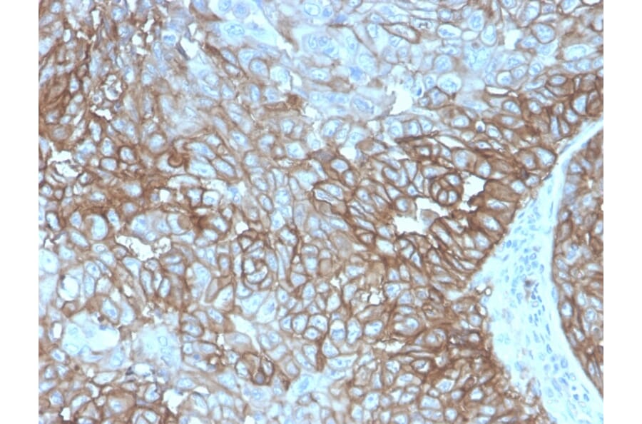 Immunohistochemistry - Anti-PD-L1 Antibody [PDL1/4280R] - BSA and Azide free (A251953) - Antibodies.com