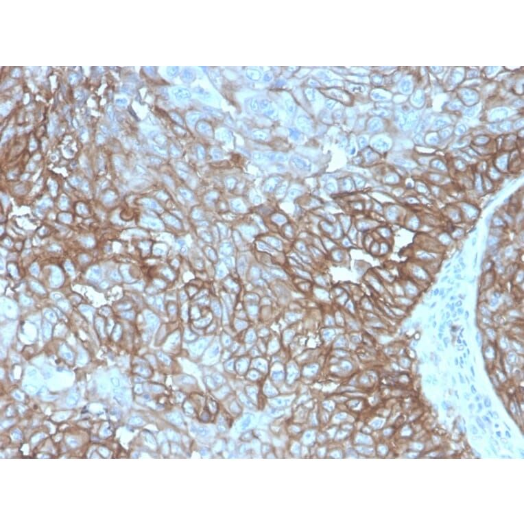 Immunohistochemistry - Anti-PD-L1 Antibody [PDL1/4280R] - BSA and Azide free (A251953) - Antibodies.com