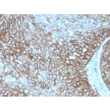 Immunohistochemistry - Anti-PD-L1 Antibody [PDL1/4280R] - BSA and Azide free (A251953) - Antibodies.com