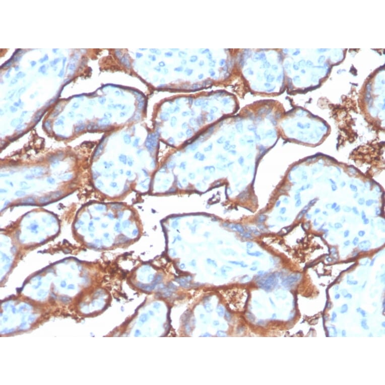 Immunohistochemistry - Anti-PD-L1 Antibody [PDL1/4280R] - BSA and Azide free (A251954) - Antibodies.com