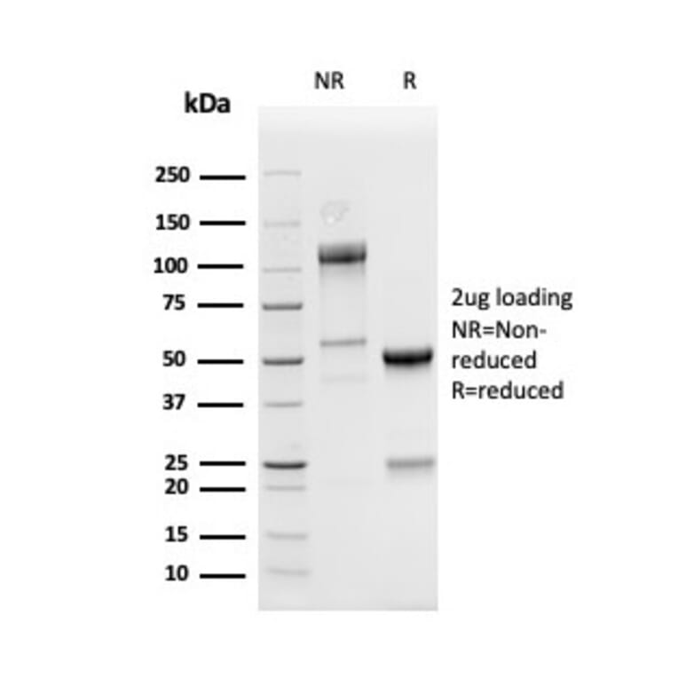 SDS-PAGE - Anti-PD-L1 Antibody [PDL1/4280R] - BSA and Azide free (A251954) - Antibodies.com