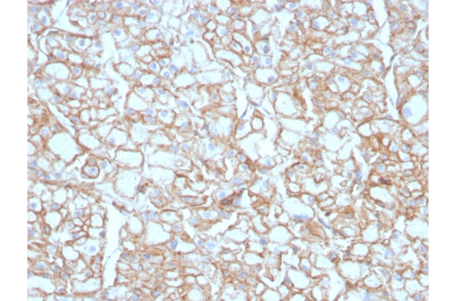 Immunohistochemistry - Anti-PD-L1 Antibody [PDL1/4451R] - BSA and Azide free (A251955) - Antibodies.com