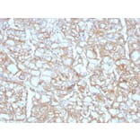 Immunohistochemistry - Anti-PD-L1 Antibody [PDL1/4451R] - BSA and Azide free (A251955) - Antibodies.com