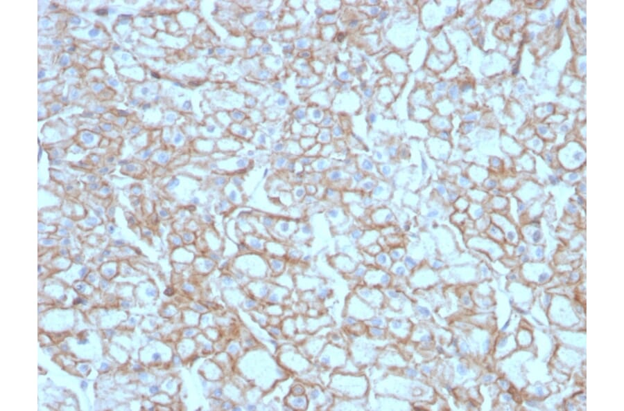 Immunohistochemistry - Anti-PD-L1 Antibody [PDL1/4451R] - BSA and Azide free (A251954) - Antibodies.com