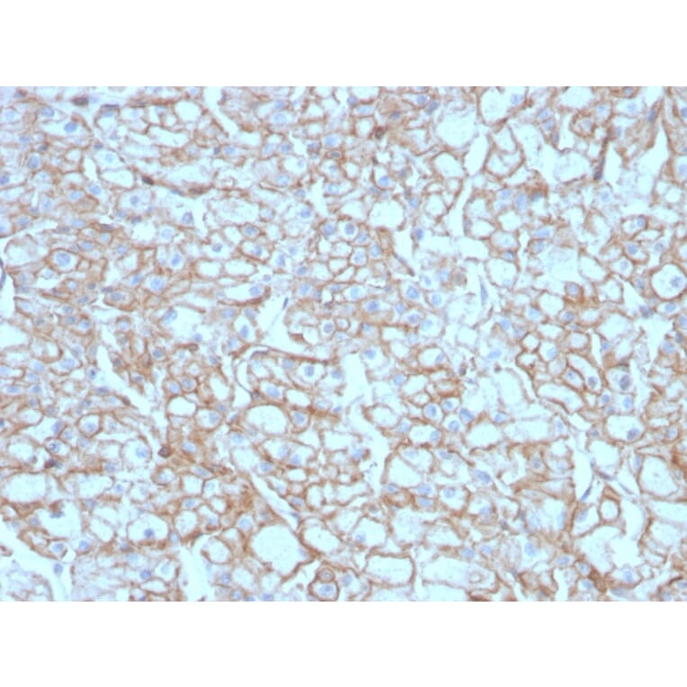 Immunohistochemistry - Anti-PD-L1 Antibody [PDL1/4451R] - BSA and Azide free (A251954) - Antibodies.com