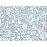 Immunohistochemistry - Anti-PD-L1 Antibody [PDL1/4451R] - BSA and Azide free (A251954) - Antibodies.com