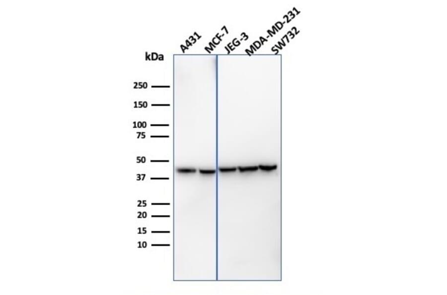 Western Blot - Anti-PD-L1 Antibody [PDL1/4451R] - BSA and Azide free (A251955) - Antibodies.com