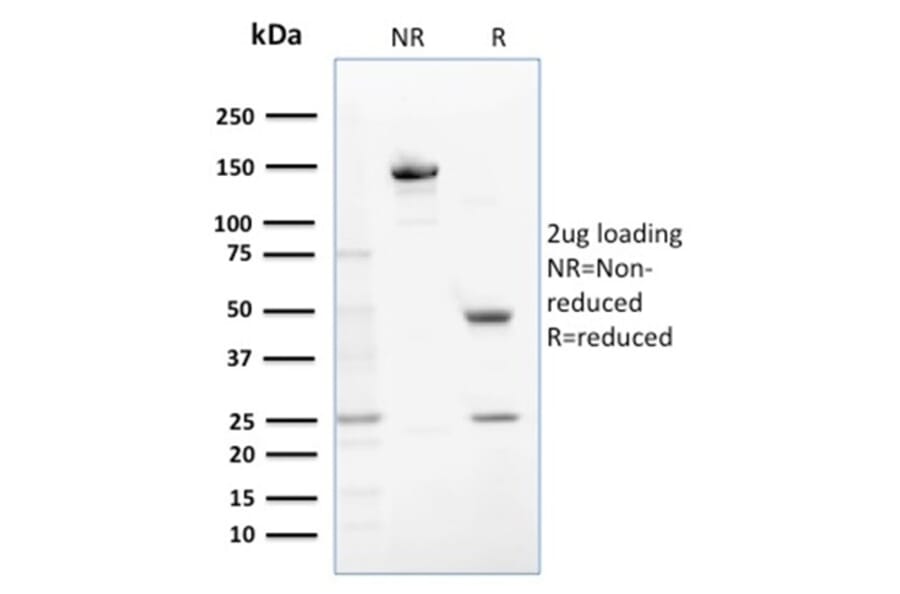 SDS-PAGE - Anti-Glutathione S Transferase Mu 1 Antibody [CPTC-GSTMu1-3] - BSA and Azide free (A251957) - Antibodies.com