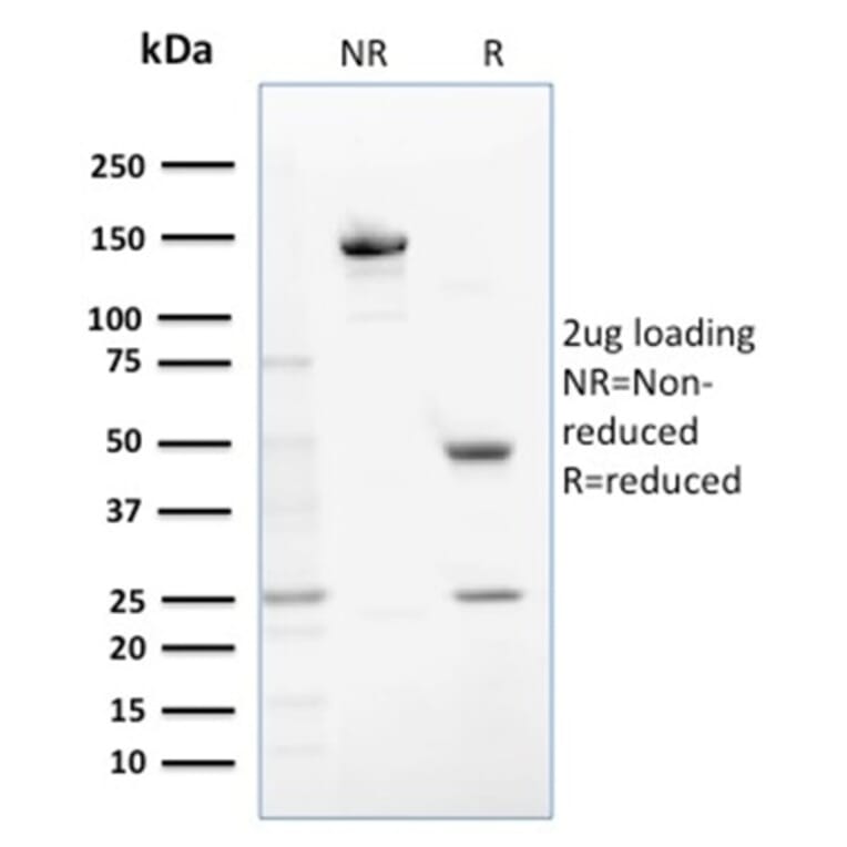 SDS-PAGE - Anti-Glutathione S Transferase Mu 1 Antibody [CPTC-GSTMu1-3] - BSA and Azide free (A251957) - Antibodies.com