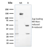 SDS-PAGE - Anti-Glutathione S Transferase Mu 1 Antibody [CPTC-GSTMu1-3] - BSA and Azide free (A251957) - Antibodies.com