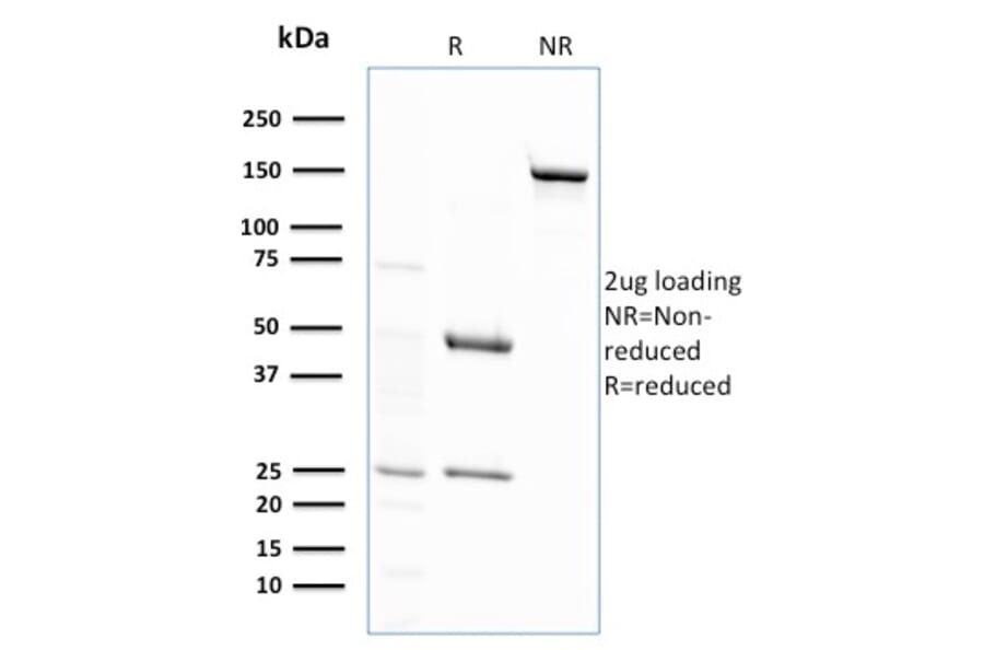 SDS-PAGE - Anti-Glutathione S Transferase Mu 2 Antibody [CPTC-GSTMu2-2] - BSA and Azide free (A251958) - Antibodies.com