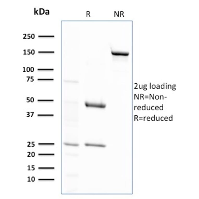 SDS-PAGE - Anti-Glutathione S Transferase Mu 2 Antibody [CPTC-GSTMu2-2] - BSA and Azide free (A251958) - Antibodies.com
