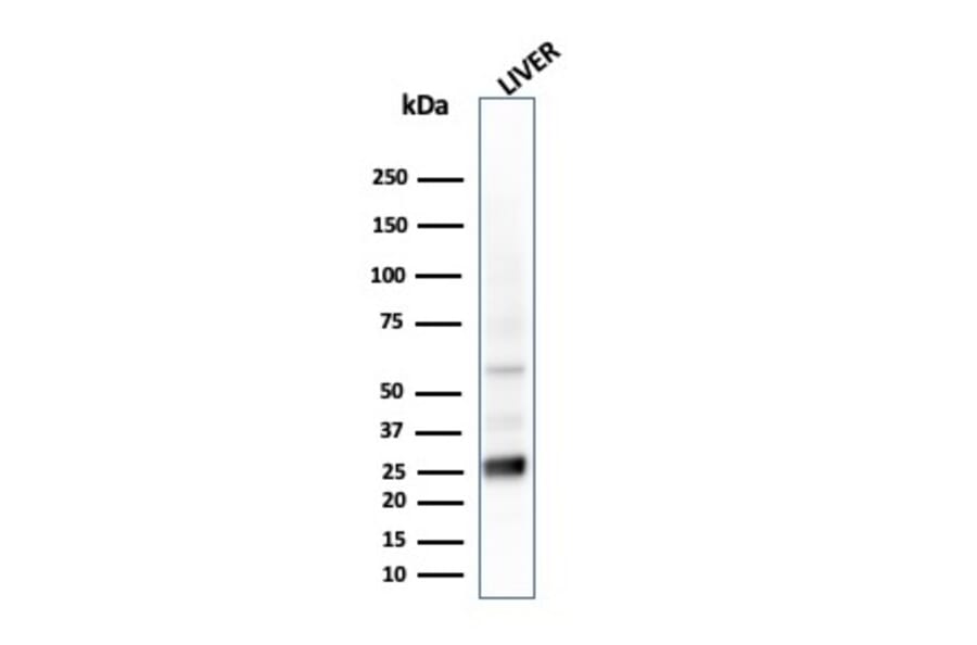 Western Blot - Anti-Glutathione S Transferase Mu 2 Antibody [CPTC-GSTMu2-2] - BSA and Azide free (A251958) - Antibodies.com