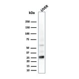 Western Blot - Anti-Glutathione S Transferase Mu 2 Antibody [CPTC-GSTMu2-2] - BSA and Azide free (A251958) - Antibodies.com