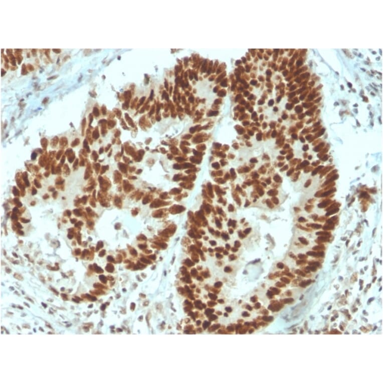 Immunohistochemistry - Anti-MSH6 Antibody [MSH6/3091] - BSA and Azide free (A251960) - Antibodies.com