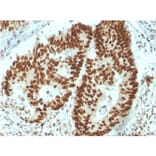 Immunohistochemistry - Anti-MSH6 Antibody [MSH6/3091] - BSA and Azide free (A251960) - Antibodies.com